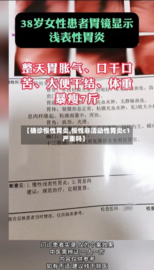 【确诊慢性胃炎,慢性非活动性胃炎c1严重吗】
