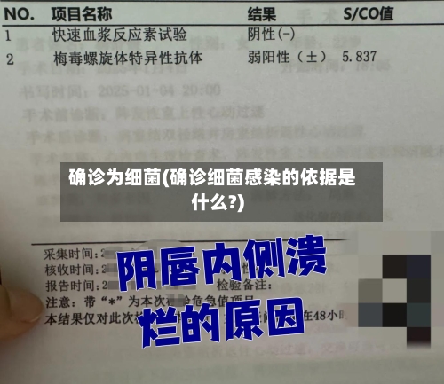确诊为细菌(确诊细菌感染的依据是什么?)-第2张图片