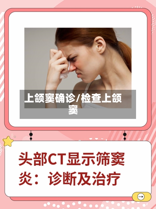 上颌窦确诊/检查上颌窦
