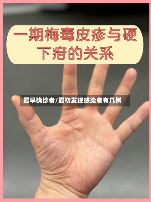 最早确诊者/最初发现感染者有几例-第2张图片
