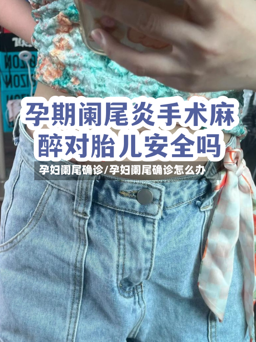 孕妇阑尾确诊/孕妇阑尾确诊怎么办-第3张图片
