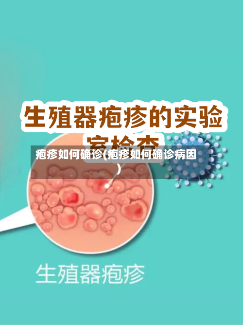 疱疹如何确诊(疱疹如何确诊病因)-第2张图片