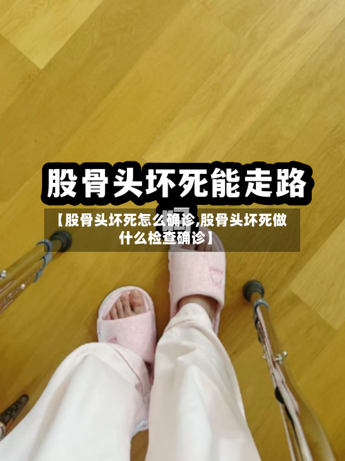 【股骨头坏死怎么确诊,股骨头坏死做什么检查确诊】-第2张图片