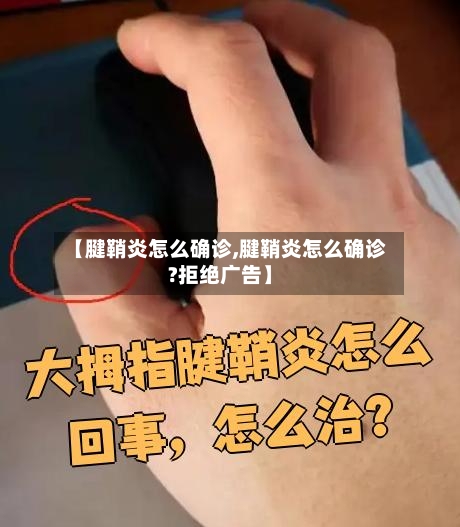 【腱鞘炎怎么确诊,腱鞘炎怎么确诊?拒绝广告】-第2张图片