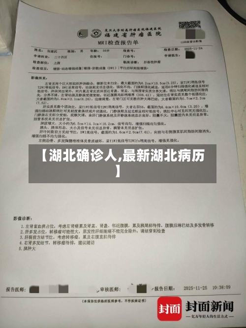 【湖北确诊人,最新湖北病历】-第3张图片