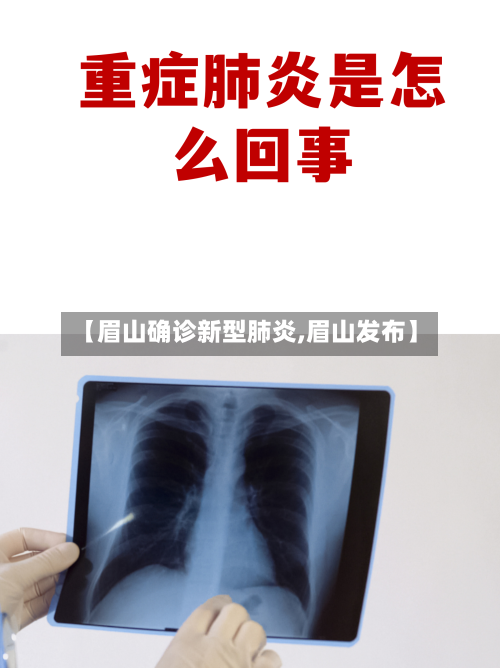 【眉山确诊新型肺炎,眉山发布】