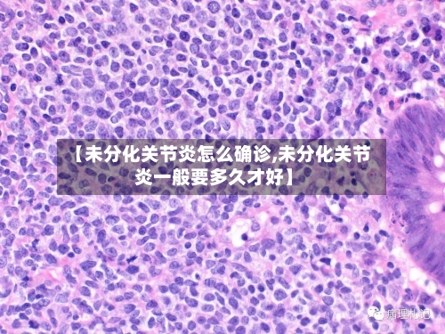 【未分化关节炎怎么确诊,未分化关节炎一般要多久才好】