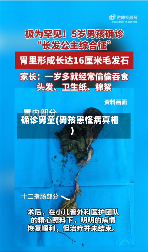 确诊男童(男孩患怪病真相)-第2张图片
