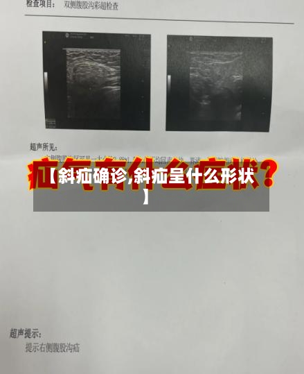 【斜疝确诊,斜疝呈什么形状】-第3张图片