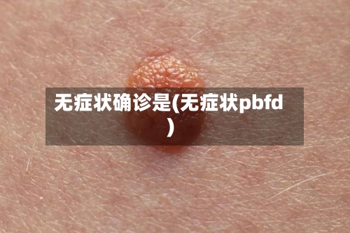 无症状确诊是(无症状pbfd)-第3张图片
