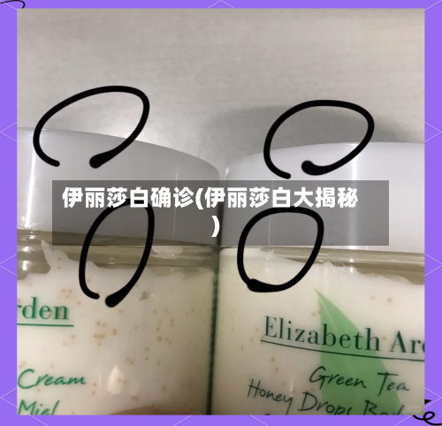 伊丽莎白确诊(伊丽莎白大揭秘)-第2张图片